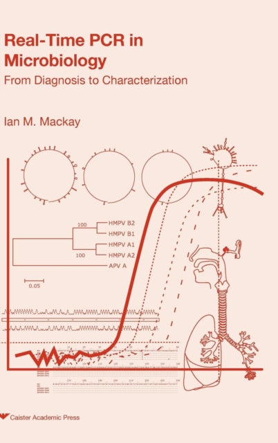 Real-time PCR in Microbiology: From Diagnosis to
