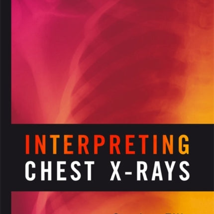 Interpreting Chest X-Rays