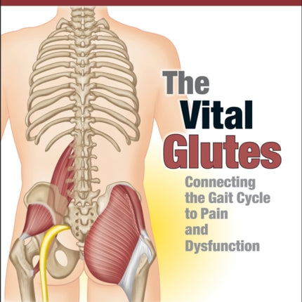 The Vital Glutes: Connecting the Gait Cycle to Pain and Dysfunction