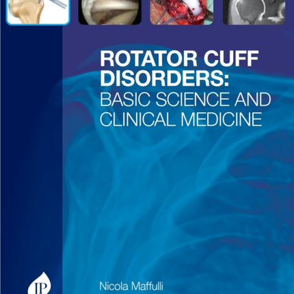 Rotator Cuff Disorders: Basic Science and Clinical Medicine