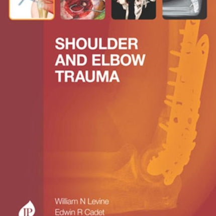 Shoulder and Elbow Trauma