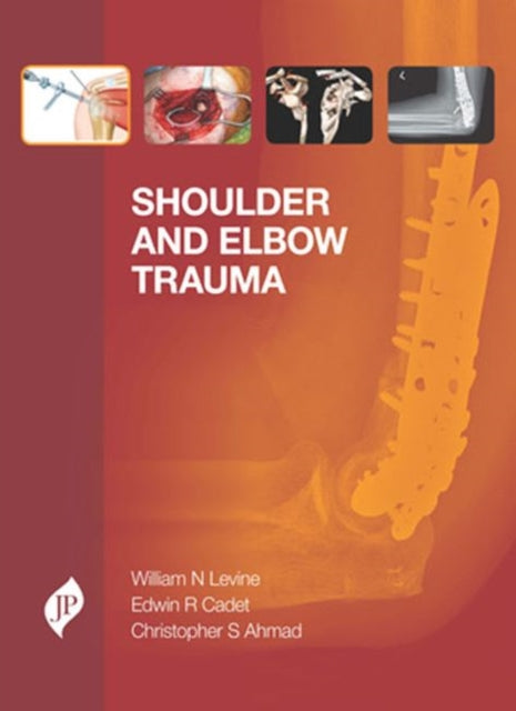 Shoulder and Elbow Trauma