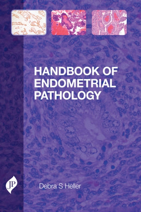 Handbook of Endometrial Pathology
