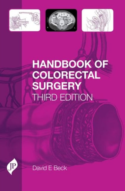 Handbook of Colorectal Surgery: Third Edition