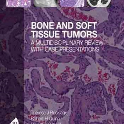 Bone and Soft Tissue Tumors: A Multidisciplinary Review with Case Presentations