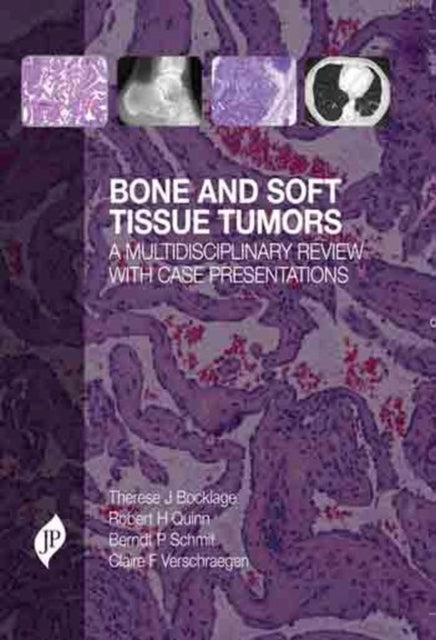 Bone and Soft Tissue Tumors: A Multidisciplinary Review with Case Presentations