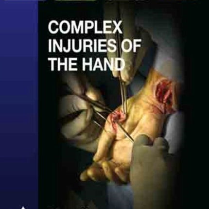 Complex Injuries of the Hand