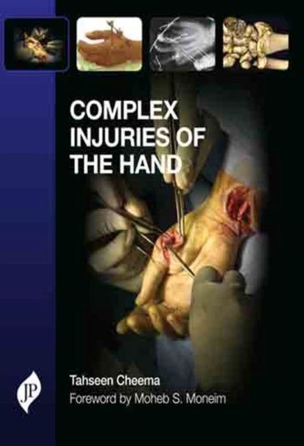 Complex Injuries of the Hand