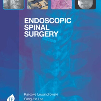 Endoscopic Spinal Surgery