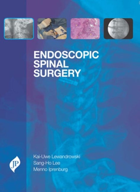 Endoscopic Spinal Surgery