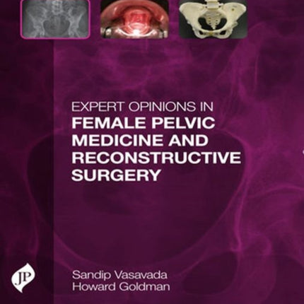 Expert Opinions in Female Pelvic Medicine and Reconstructive Surgery