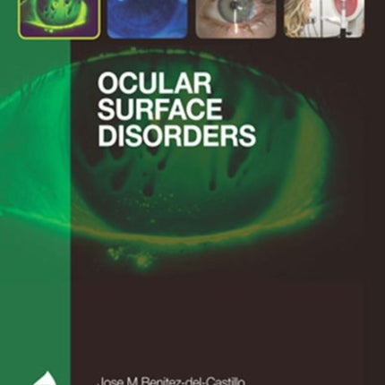 Ocular Surface Disorders