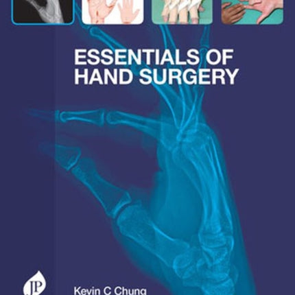 Essentials of Hand Surgery