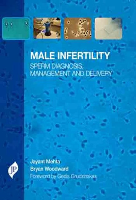 Male Infertility: Sperm Diagnosis, Management and Delivery