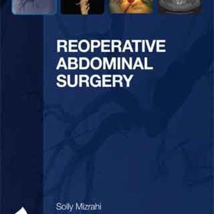 Reoperative Abdominal Surgery