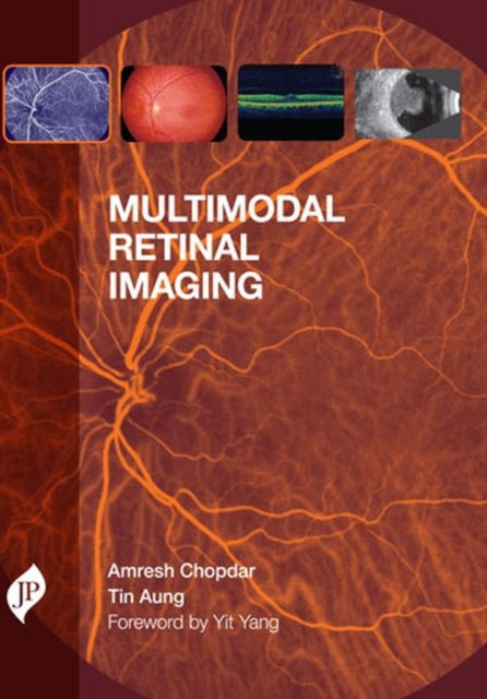 Multimodal Retinal Imaging