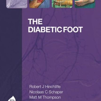 The Diabetic Foot