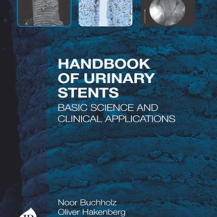 Handbook of Urinary Stents: Basic Science and Clinical Applications