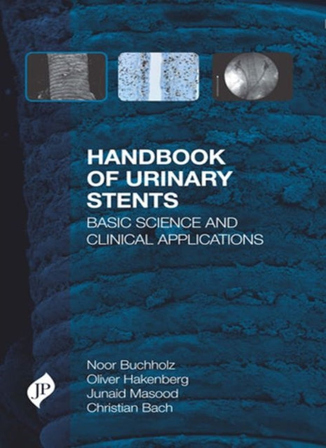 Handbook of Urinary Stents: Basic Science and Clinical Applications