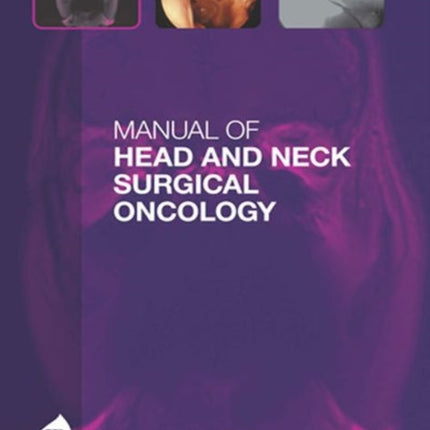 Manual of Head and Neck Surgical Oncology