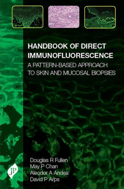 Handbook of Direct Immunofluorescence: A