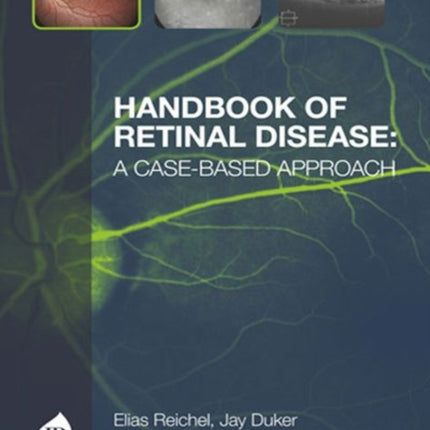 Handbook of Retinal Disease a Casebased Approach