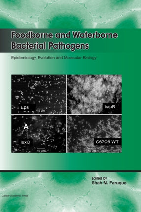 Foodborne and Waterborne Bacterial Pathogens: