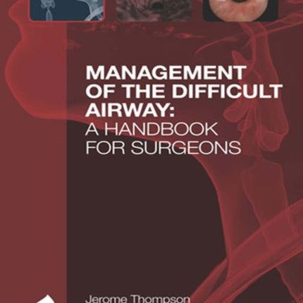 Management of the Difficult Airway: A Handbook for Surgeons