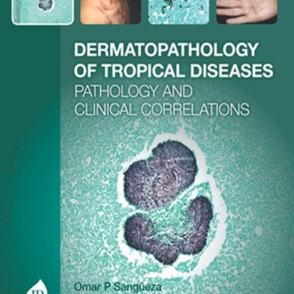 Dermatopathology of Tropical Diseases: Pathology and Clinical Correlations