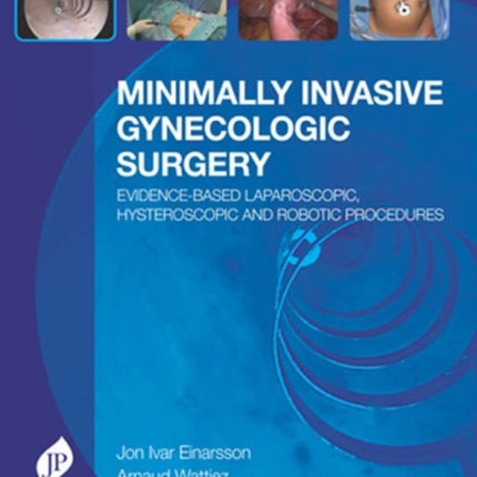 Minimally Invasive Gynecologic Surgery: