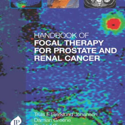 Handbook of Focal Therapy for Prostate and Renal Cancer