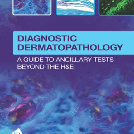 Diagnostic Dermatopathology: A Guide to Ancillary Tests Beyond the H&E