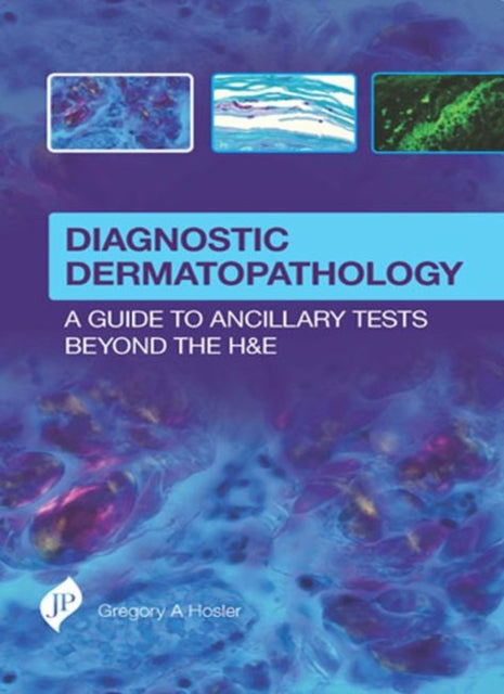 Diagnostic Dermatopathology: A Guide to Ancillary Tests Beyond the H&E