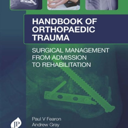 Handbook of Orthopaedic Trauma: Surgical
