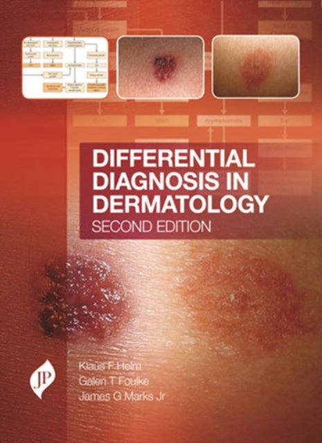 Differential Diagnosis in Dermatology