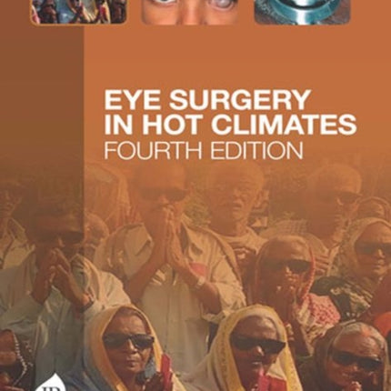 Eye Surgery in Hot Climates