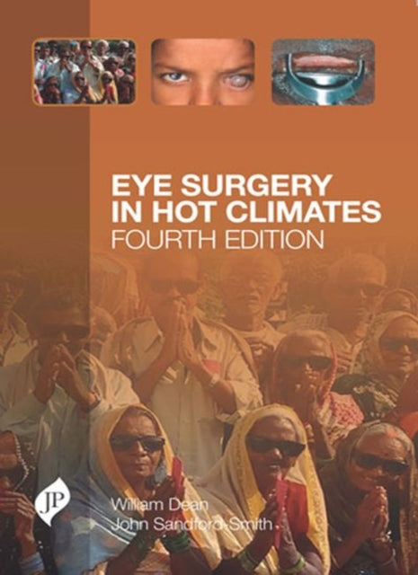 Eye Surgery in Hot Climates