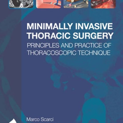 Minimally Invasive Thoracic Surgery: Principles and Practice of Thoracoscopic Technique