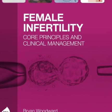 Female Infertility: Core Principles and Clinical Management