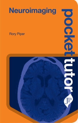 Pocket Tutor Neuroimaging