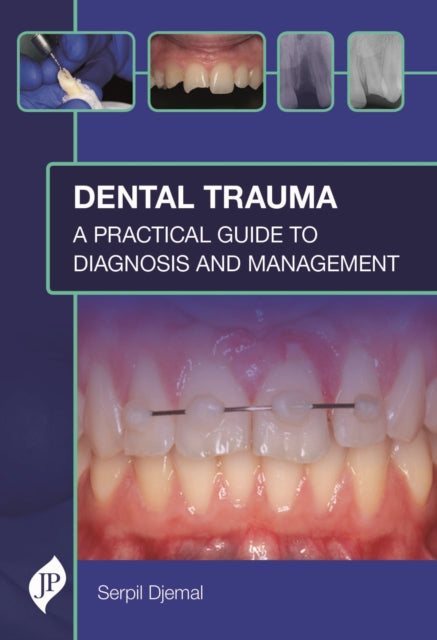 Dental Trauma: A Practical Guide to Diagnosis and Management