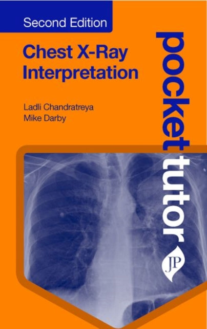 Pocket Tutor Chest X-Ray Interpretation: Second Edition