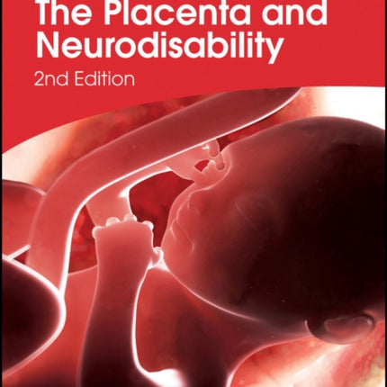 The Placenta and Neurodisability