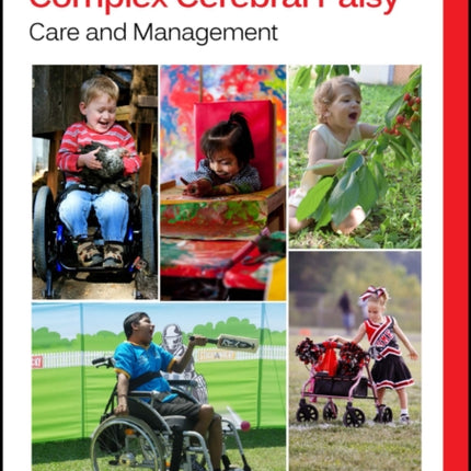 Children and Youth with Complex Cerebral Palsy: Care and Management