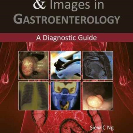 Clinical Challenges & Images in Gastroenterology: A Diagnostic Guide