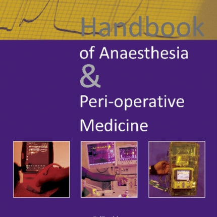 Handbook of Anaesthesia & Peri-operative Medicine