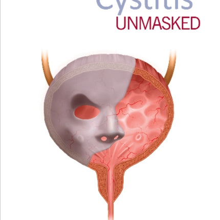 Cystitis Unmasked