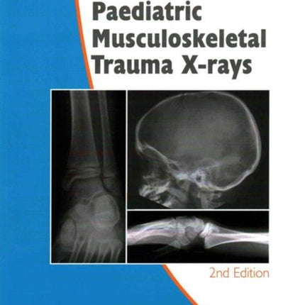 Self-Assessment in Paediatric Musculoskeletal