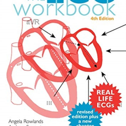 The ECG Workbook