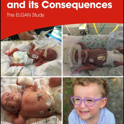 Extremely Preterm Birth and its Consequences: The ELGAN Study